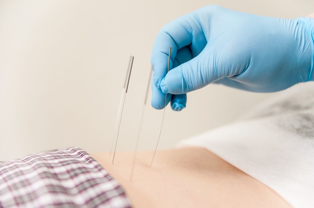 Behandlung der torakalen Osteocondrose