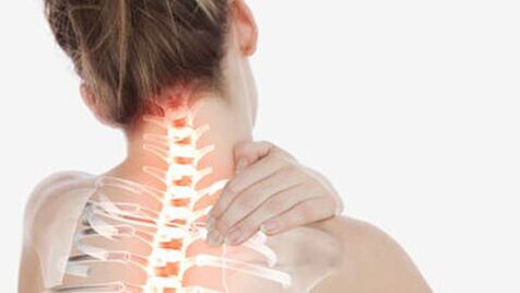 Osteochondrose der Halsspalte