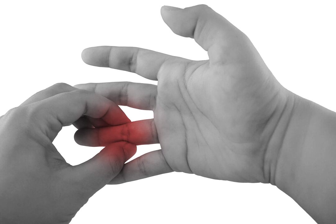 Entzündung der Fingergelenke als Schmerzursache